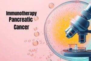 immunotherapy for pancreatic cancer