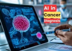 AI in Cancer Diagnosis