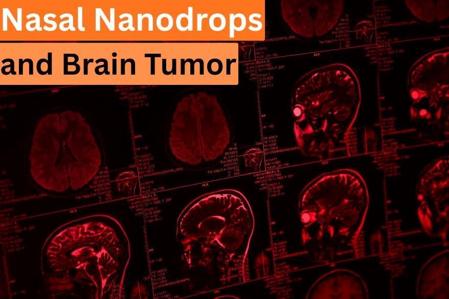 nasal nanodrops and brain tumor