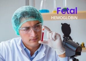 Fetal Hemoglobin