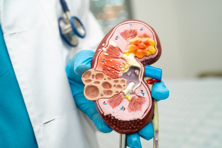 kidney cancer power hubs