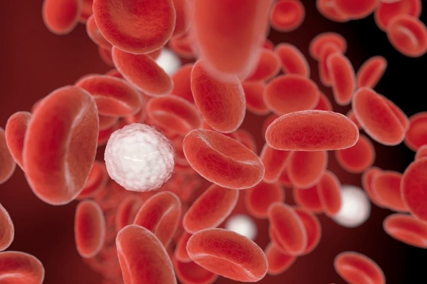 CytoDiffusion-to detect leukemia