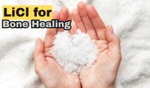 Lithium Chloride Enhances Bone Healing