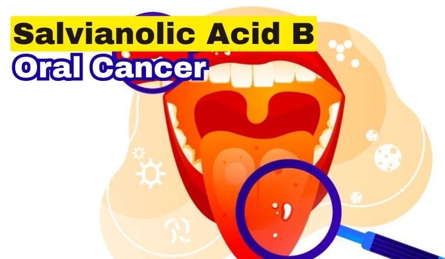 Salvianolic Acid B in Oral Cancer