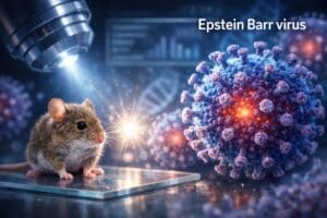 Epstein Barr virus