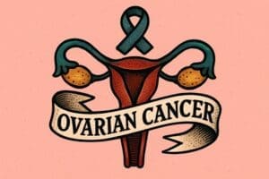 ovarian cancer cell invasion