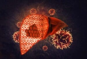 protein intake liver cancer