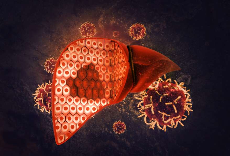 protein intake liver cancer