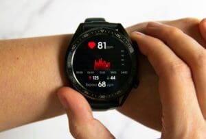 Affective AI in Healthcare Systems